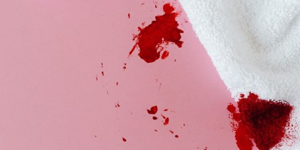 como quitar manchas de sangre en la ropa
